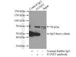 FOXP2 Antibody in Immunoprecipitation (IP)