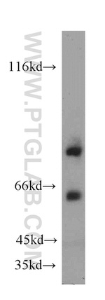 FOXP2 Antibody in Western Blot (WB)