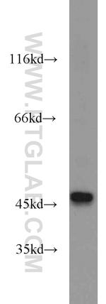 RUNDC3A Antibody in Western Blot (WB)