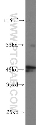 RUNDC3A Antibody in Western Blot (WB)