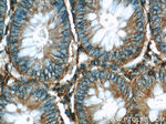 beta Actin Antibody in Immunohistochemistry (Paraffin) (IHC (P))