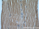 beta Actin Antibody in Immunohistochemistry (Paraffin) (IHC (P))