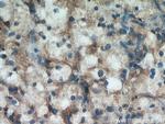 ZNF839 Antibody in Immunohistochemistry (Paraffin) (IHC (P))