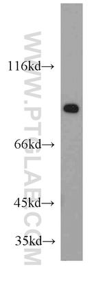 ZNF839 Antibody in Western Blot (WB)