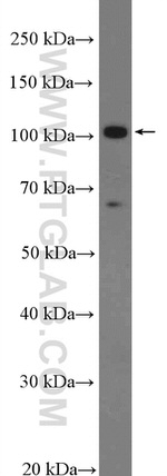 AXIN2 Antibody in Western Blot (WB)