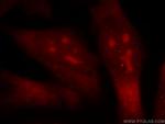 TOP2B Antibody in Immunocytochemistry (ICC/IF)