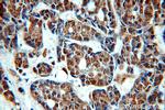 TOP2B Antibody in Immunohistochemistry (Paraffin) (IHC (P))