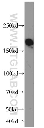 TOP2B Antibody in Western Blot (WB)