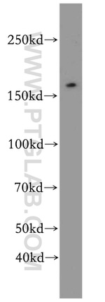 TOP2B Antibody in Western Blot (WB)