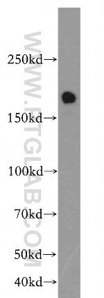 TOP2B Antibody in Western Blot (WB)