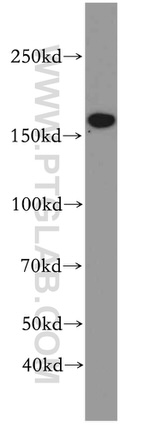 TOP2B Antibody in Western Blot (WB)