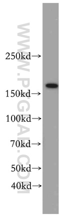 TOP2B Antibody in Western Blot (WB)