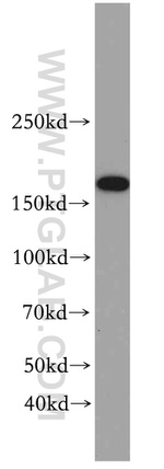 TOP2B Antibody in Western Blot (WB)