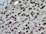 PARP2 Antibody in Immunohistochemistry (Paraffin) (IHC (P))