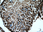 PARP2 Antibody in Immunohistochemistry (Paraffin) (IHC (P))
