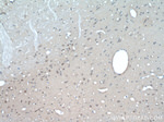 PARP2 Antibody in Immunohistochemistry (Paraffin) (IHC (P))