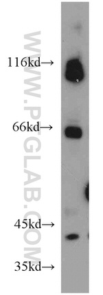 PARP2 Antibody in Western Blot (WB)