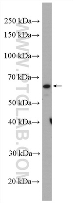 PARP2 Antibody in Western Blot (WB)