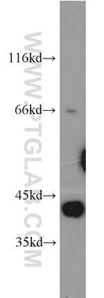 PARP2 Antibody in Western Blot (WB)