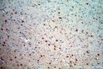 STXBP1 Antibody in Immunohistochemistry (Paraffin) (IHC (P))