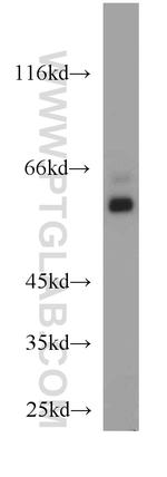 STXBP1 Antibody in Western Blot (WB)