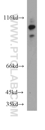 DDX58 Antibody in Western Blot (WB)