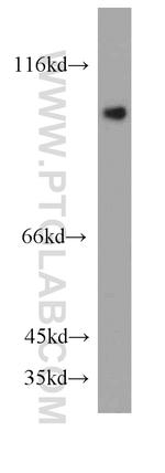 DDX58 Antibody in Western Blot (WB)