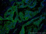 DICER1 Antibody in Immunohistochemistry (PFA fixed) (IHC (PFA))