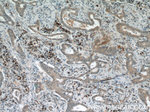 DICER1 Antibody in Immunohistochemistry (Paraffin) (IHC (P))