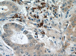 DICER1 Antibody in Immunohistochemistry (Paraffin) (IHC (P))