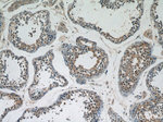 DICER1 Antibody in Immunohistochemistry (Paraffin) (IHC (P))