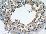 DICER1 Antibody in Immunohistochemistry (Paraffin) (IHC (P))