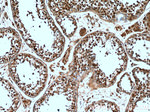 DICER1 Antibody in Immunohistochemistry (Paraffin) (IHC (P))