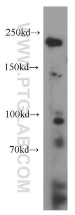 DICER1 Antibody in Western Blot (WB)