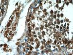 DICER1 Antibody in Immunohistochemistry (Paraffin) (IHC (P))