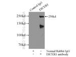 DICER1 Antibody in Immunoprecipitation (IP)