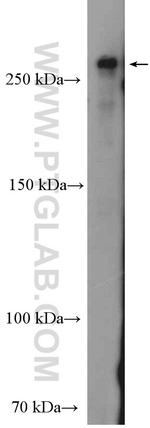 DICER1 Antibody in Western Blot (WB)