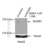 DICER1 Antibody in Western Blot (WB)