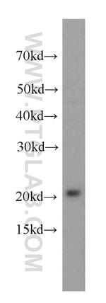 peroxiredoxin 2 Antibody in Western Blot (WB)