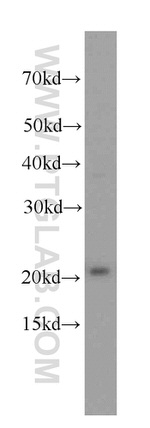 peroxiredoxin 2 Antibody in Western Blot (WB)