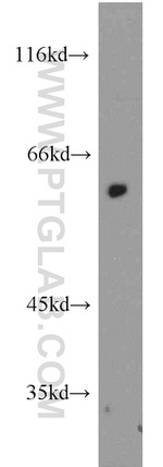 PAX7 Antibody in Western Blot (WB)