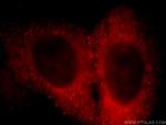 DOC2B Antibody in Immunocytochemistry (ICC/IF)