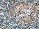 PERK/EIF2AK3 Antibody in Immunohistochemistry (Paraffin) (IHC (P))