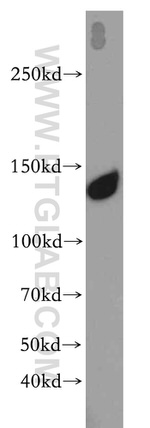 PERK/EIF2AK3 Antibody in Western Blot (WB)