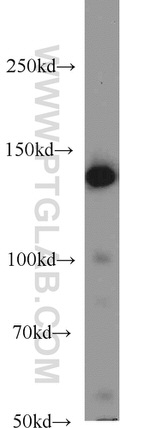 PERK/EIF2AK3 Antibody in Western Blot (WB)