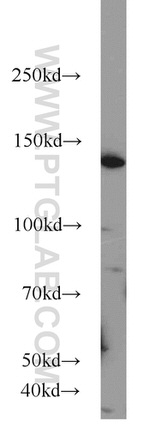 PERK/EIF2AK3 Antibody in Western Blot (WB)