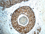 CD9 Antibody in Immunohistochemistry (Paraffin) (IHC (P))