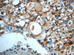 CD9 Antibody in Immunohistochemistry (Paraffin) (IHC (P))