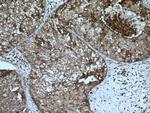 CD9 Antibody in Immunohistochemistry (Paraffin) (IHC (P))