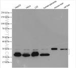 CD9 Antibody in Western Blot (WB)